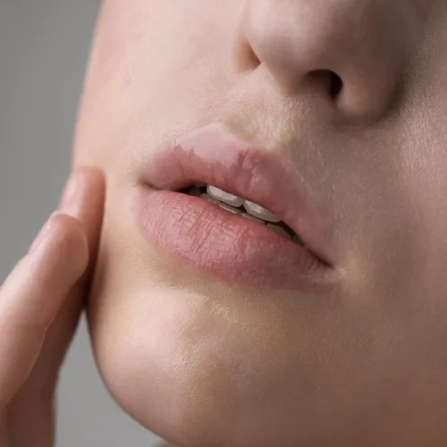 How Do I Know If I Have Herpes or a Pimple?